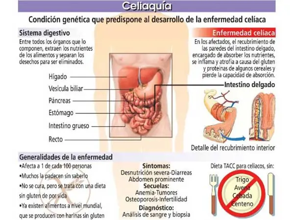 alimentos