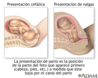 mujer