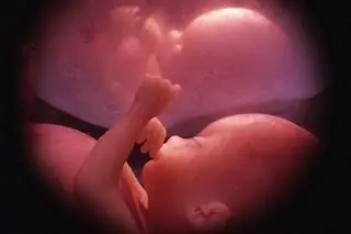 ¿Progreso o deshumanización?: Eugenesia.