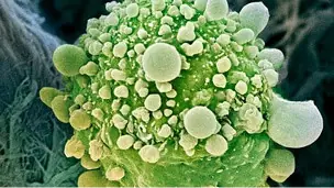 Hallan gen que detiene el cáncer de páncreas