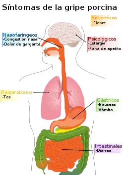 Gripe A