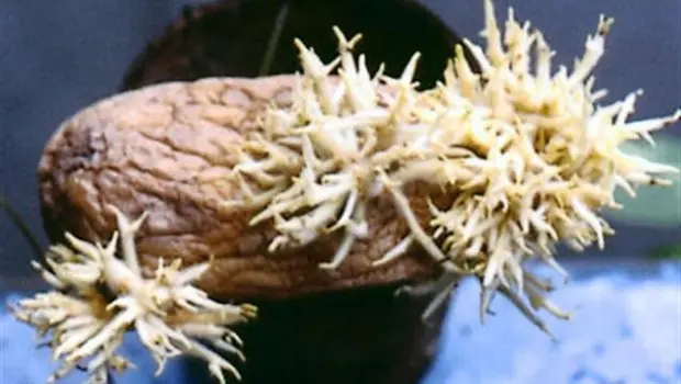 Extraen papa germinada de útero de una joven