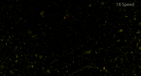 reaciones a nivel microscopico