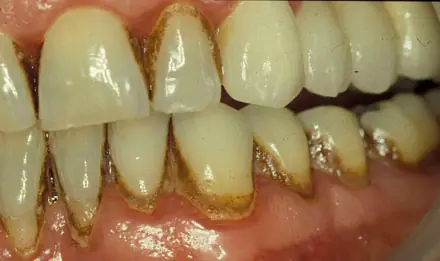 dentista