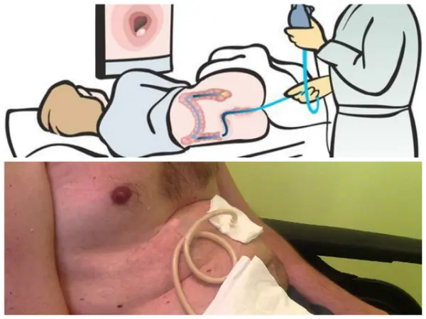 medicina