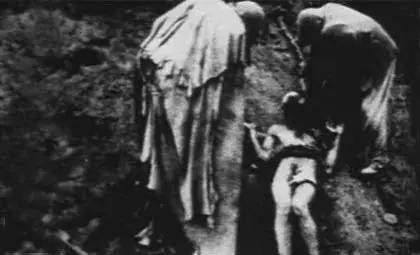 mutilacion