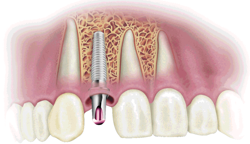 dientes