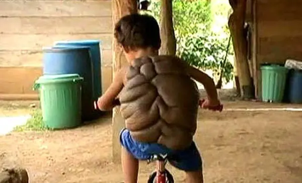 tortuga