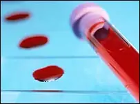 ¿Por que Las Venas Se ven Azules si la sangre es roja?