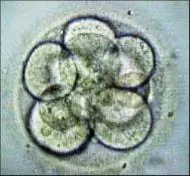 celulas madre