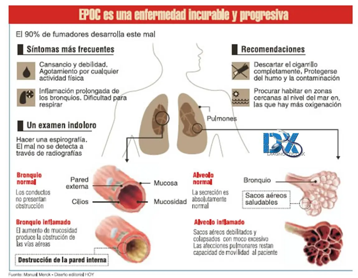 enfermedades respiratorias