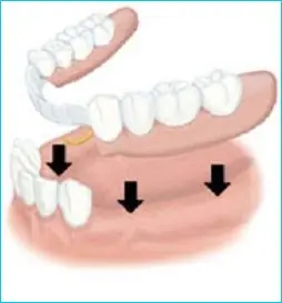 chaja
