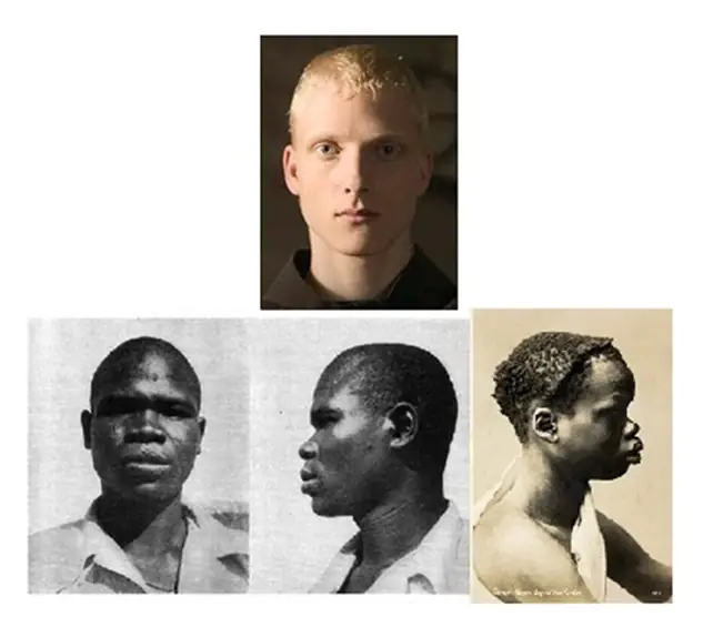Diferencias entre mongoloides negros y caucasoides