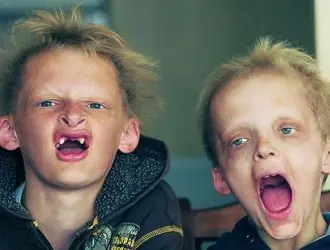 Niños