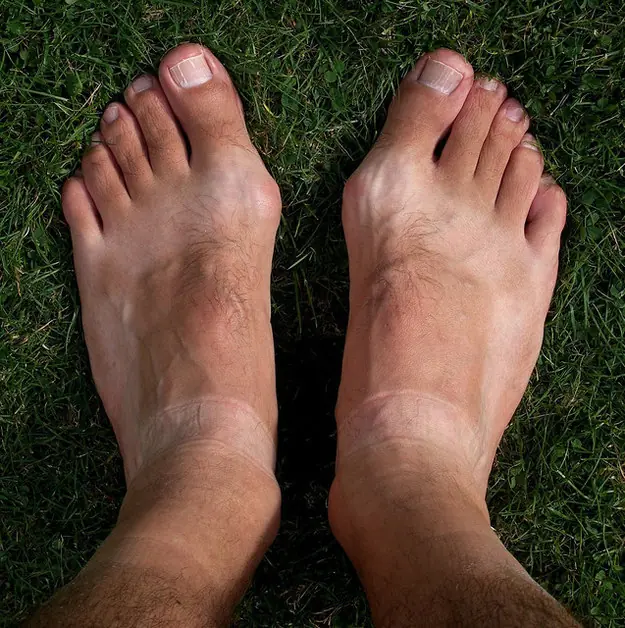 25 razones por las que el verano es el enemigo