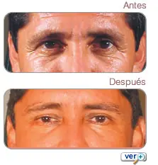 Cirugías estéticas en hombres!