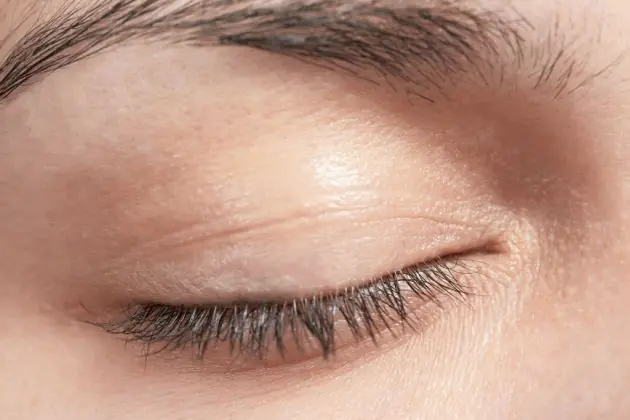 ojo