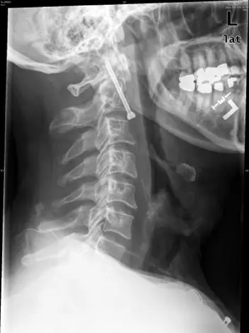 Las radiografías más insólitas (Parte II)