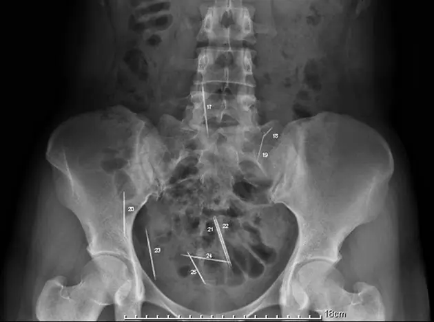 radiografias