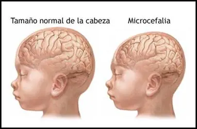 problema