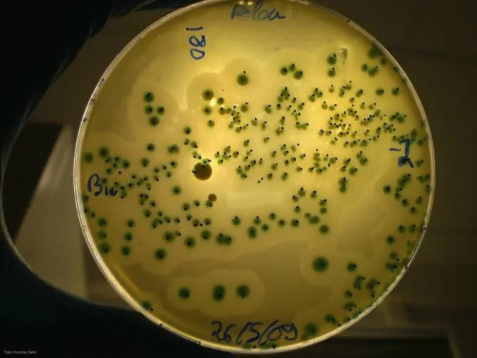 Viajes internacionales, canal de entrada de bacterias