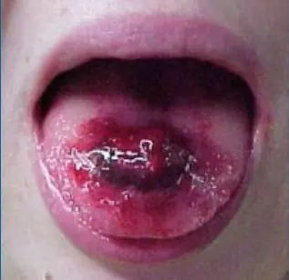 cosas de Los Piercings