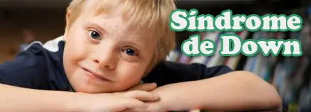Síndrome de Down(explicacion)