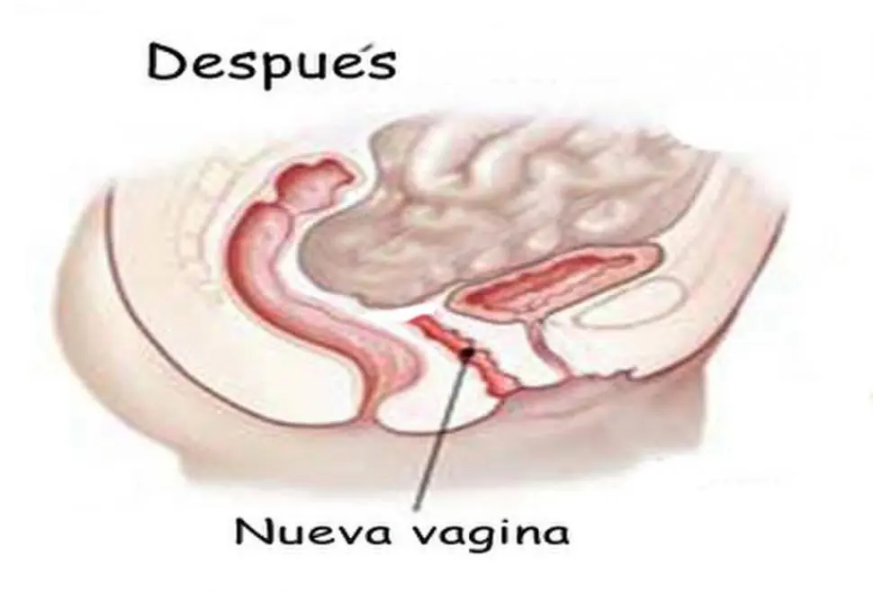 vagina