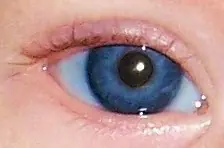 ojo