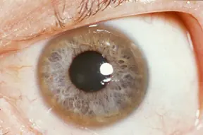 color de ojos
