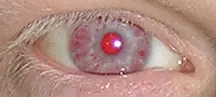 Ojos