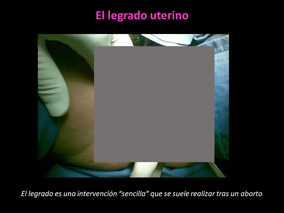 Feminismo