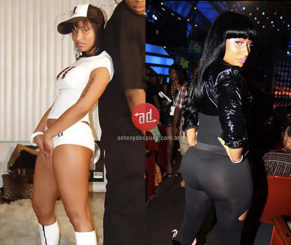 antes y despues