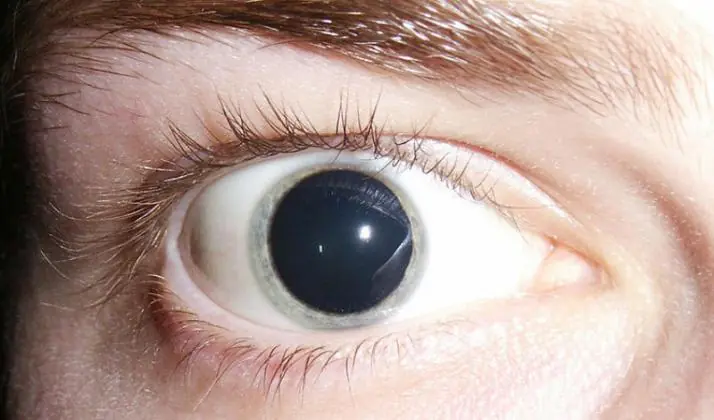 Que se siente cuando consumis LSD? te lo explico con gifs