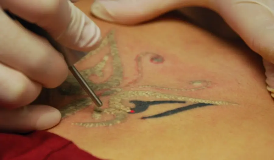 ¿Arrepentido? Qué hacer con un Tatuaje que no te gusta