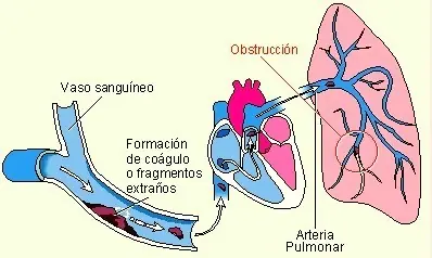 enfermedad