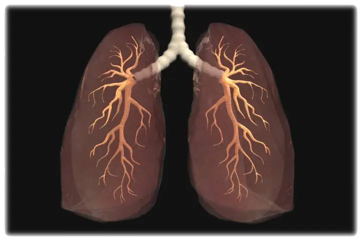 2 Enfermedades Pulmonares-Mi Resumen