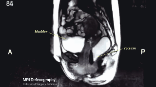 Ciencia y Educación. Gifs impresionantes