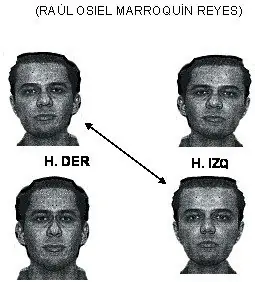 psicopatologia