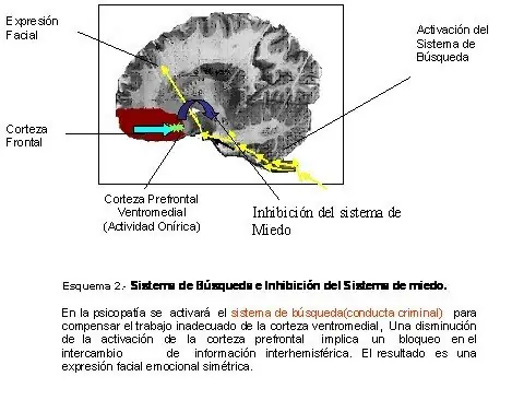 rasgos fisicos psicopata
