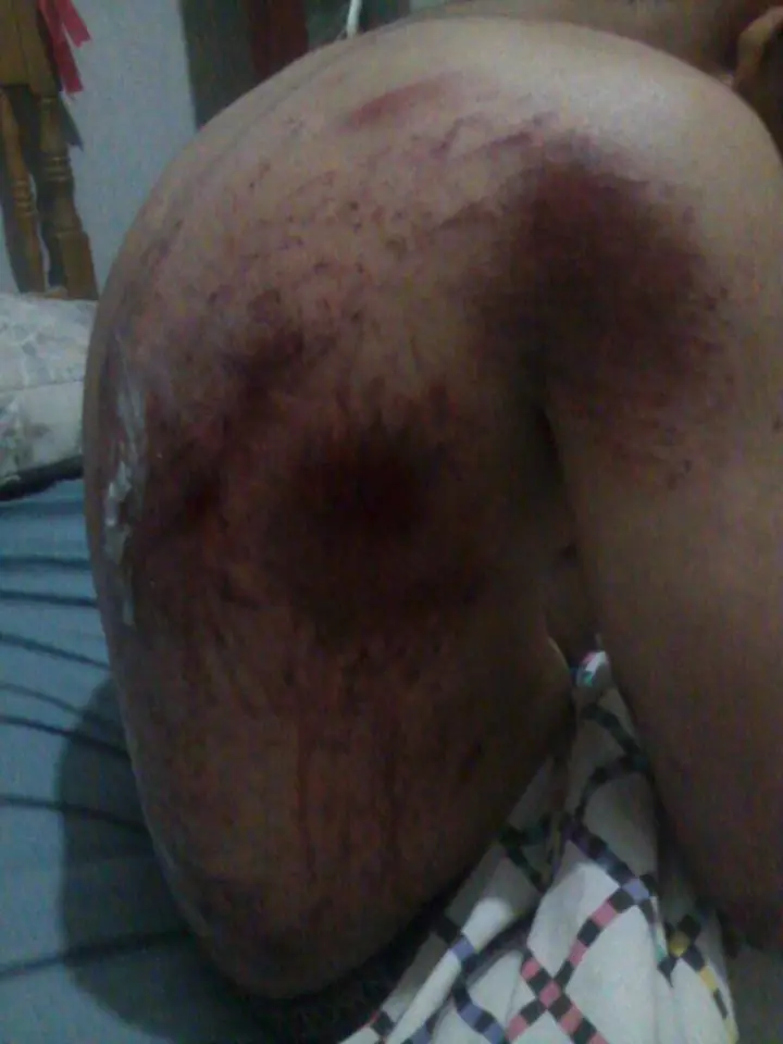 pisteando como un campeon
