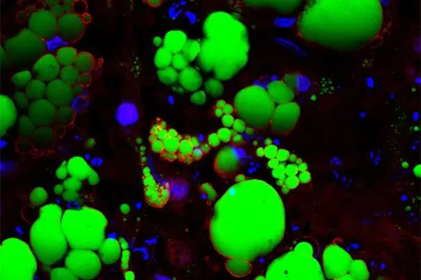 microbiologia