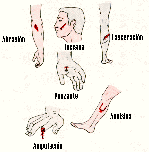 Primeros auxilios (mega-post)