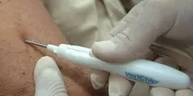 espias