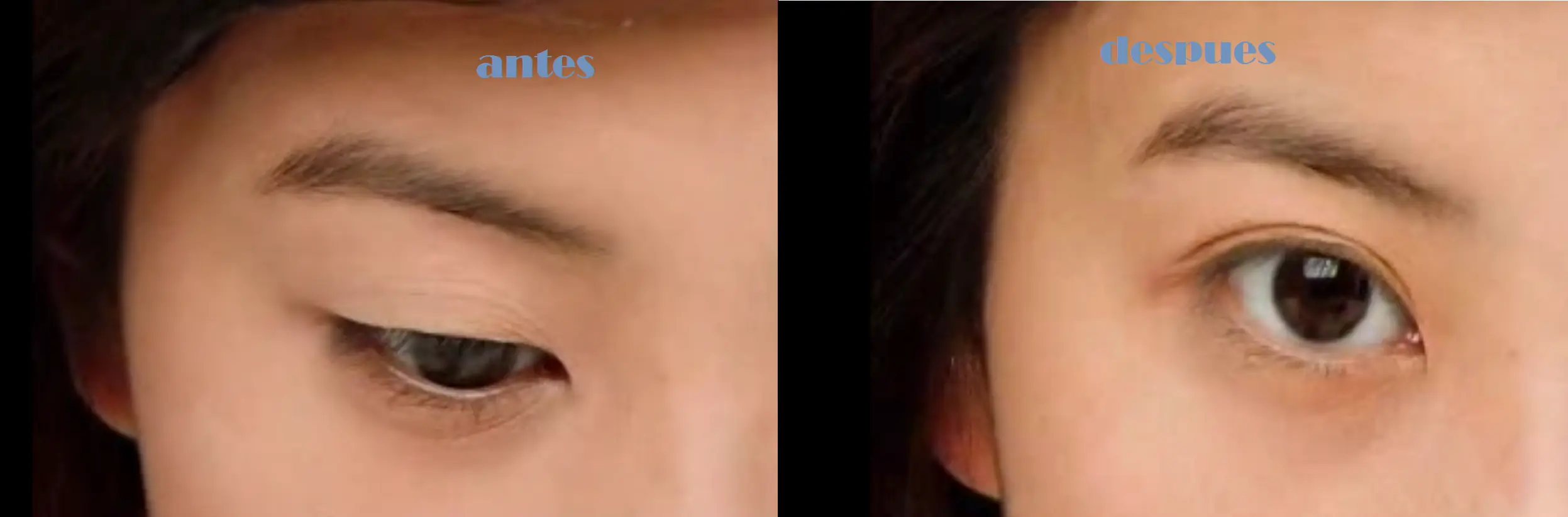 asiaticas quieren ojos cuadrados