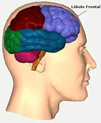 neurologia