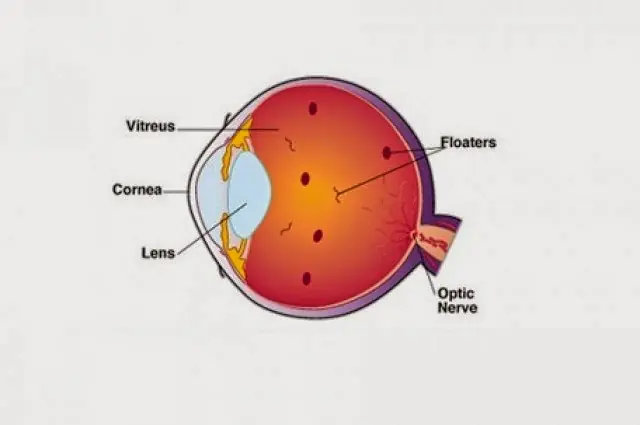 cosas raras en los ojos