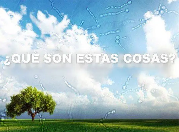 ¿Qué son esas extrañas manchas que flotan en tu ojo?