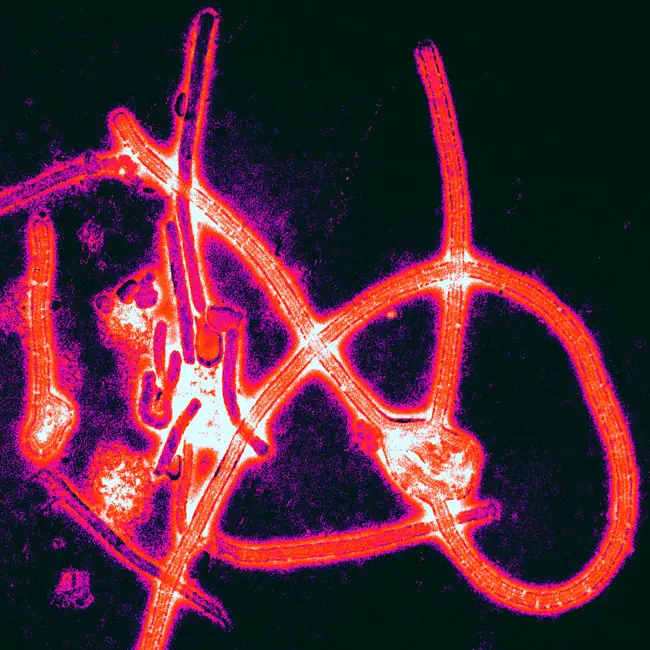 ebola