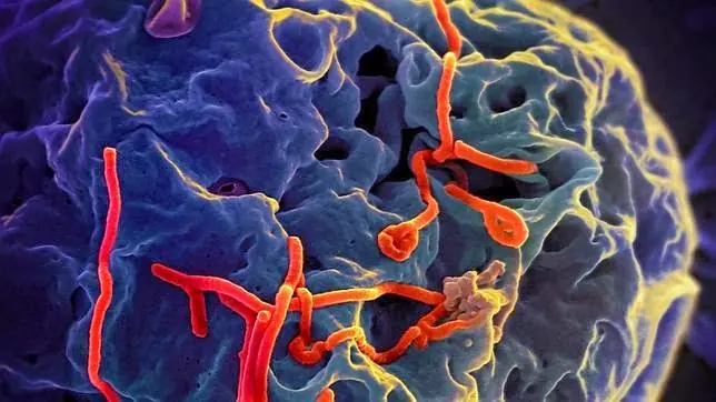 Descubren cómo el virus del ébola engaña a las defensas del